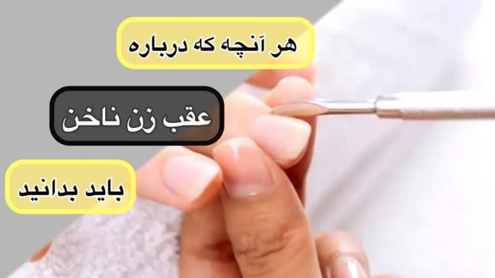 هر آنچه که درباره عقب زن ناخن باید بدانید