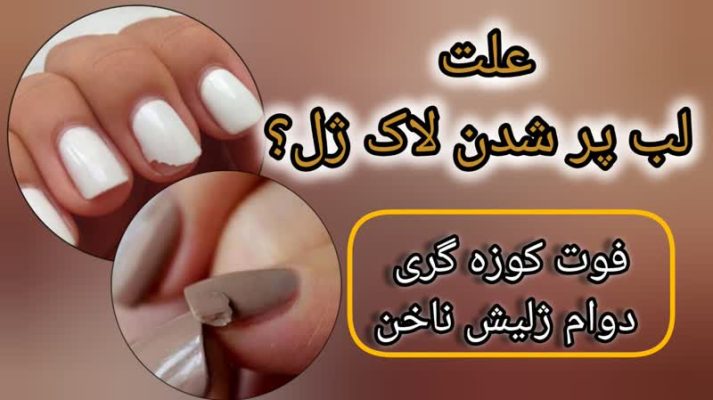علت لب پر شدن لاک ژل؟ فوت کوزه گری دوام ژلیش ناخن