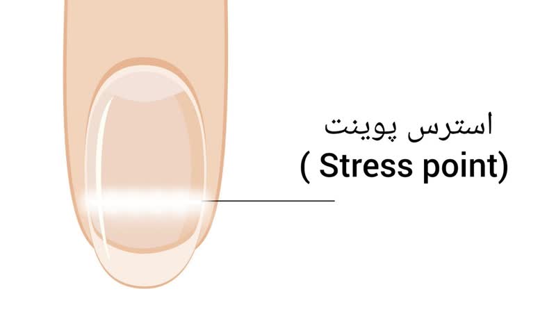 استرس پوینت (stress point)