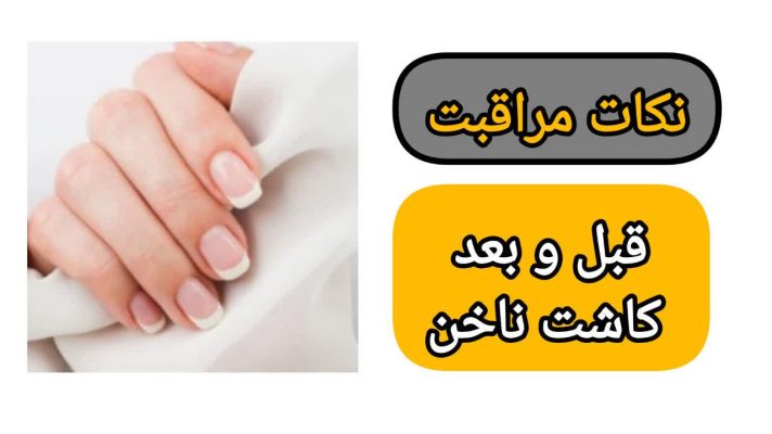 مراقبت های قبل و بعد کاشت ناخن